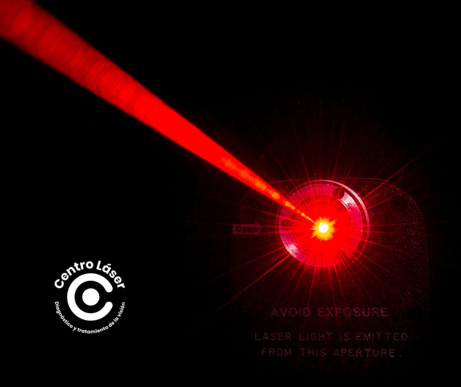 IFL interferometría láser