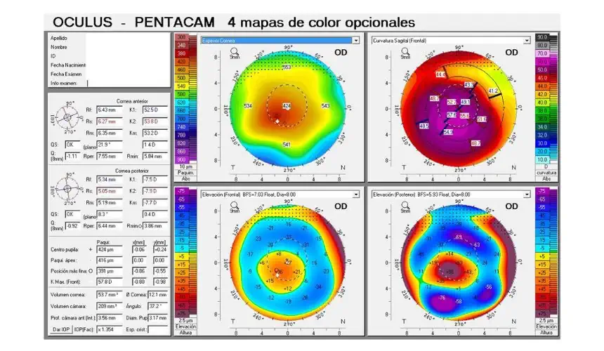 Pentacam